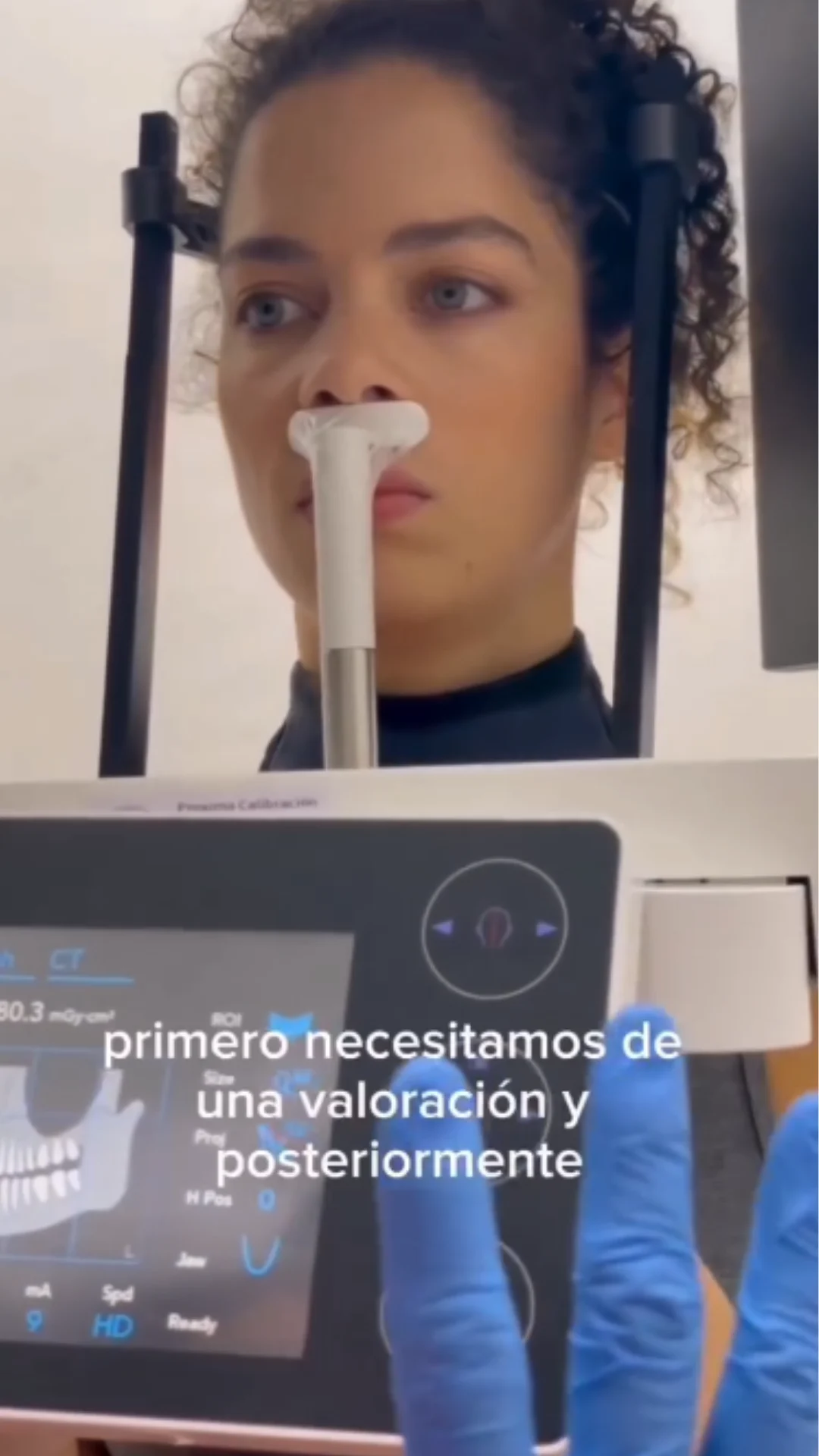 Todo sobre Alineadores Transparentes